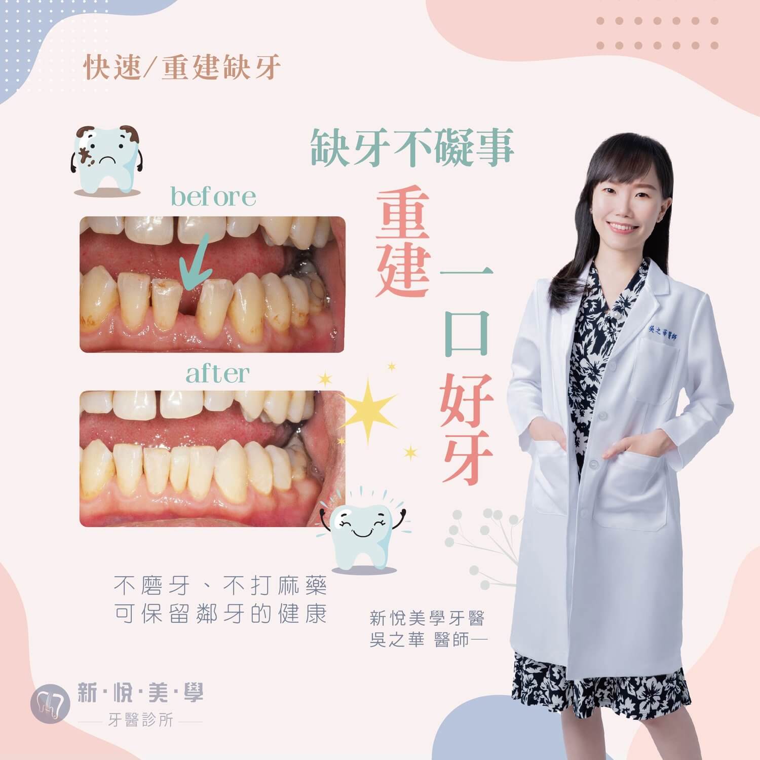 新悅美學牙醫診所的案例分享圖片